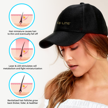 Bild in Galerie-Viewer laden, QI LITE™ Hair Regrowth Red Light Infrared Laser Cap - Qi Life Store