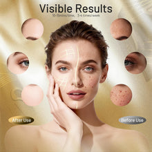Bild in Galerie-Viewer laden, Qi Radiance DermaGlow — Red + NIR Silicone Face Mask