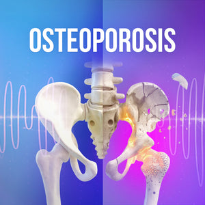 Osteoporosis - Rife+ Frequency Protocols