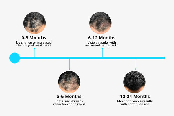 QI LITE Professional Hair Growth & Stop Hair Loss System.