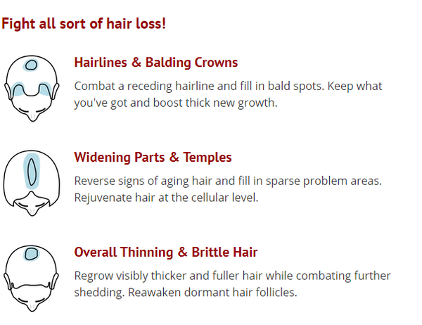 Hair Loss Treatment - QI LITE Infrared Laser Cap LED Light Therapy.