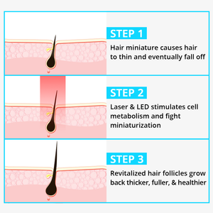 QI LITE Professional Hair Growth & Stop Hair Loss System. - Qi Life Store 