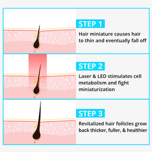 Qi Lite Professional Hair Growth & Stop Loss System